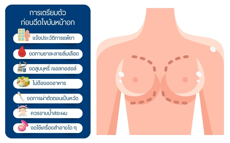 การเตรียมตัวก่อนฉีดไขมันหน้าอก