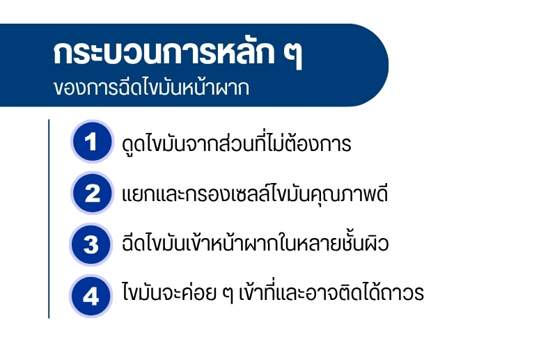 การฉีดไขมันหน้าผาก คืออะไร?