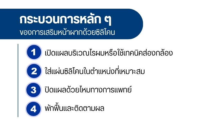 เสริมหน้าผากด้วยซิลิโคน คืออะไร?