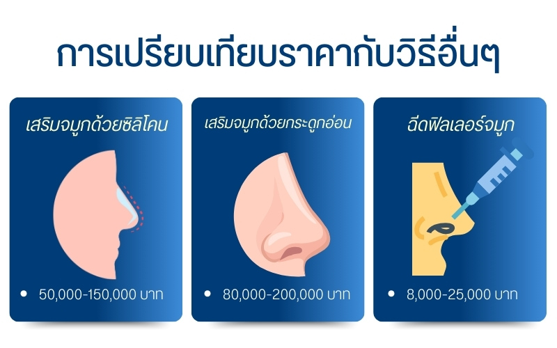 การเปรียบเทียบราคากับวิธีอื่น