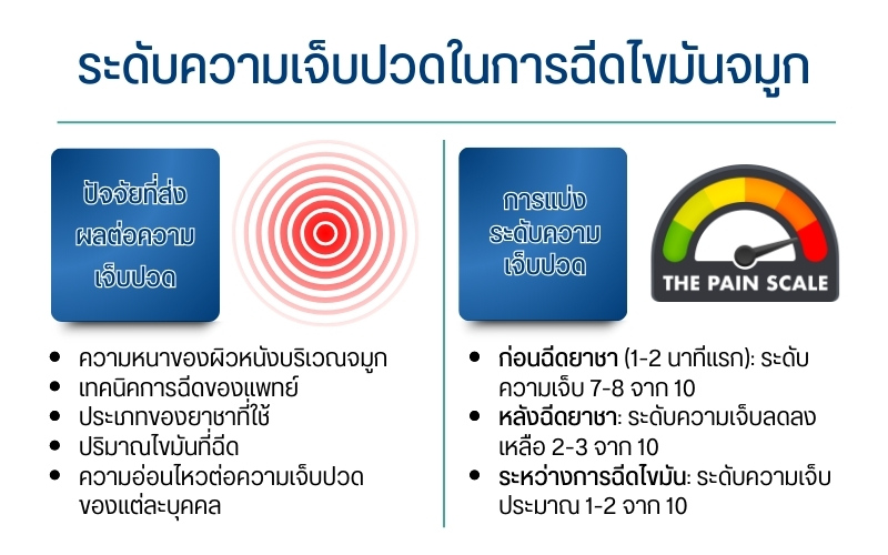 ฉีดไขมันจมูก เจ็บไหม