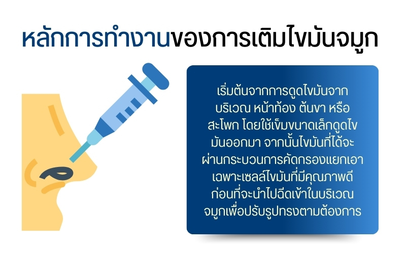 ทำความรู้จักกับการเติมไขมันจมูก