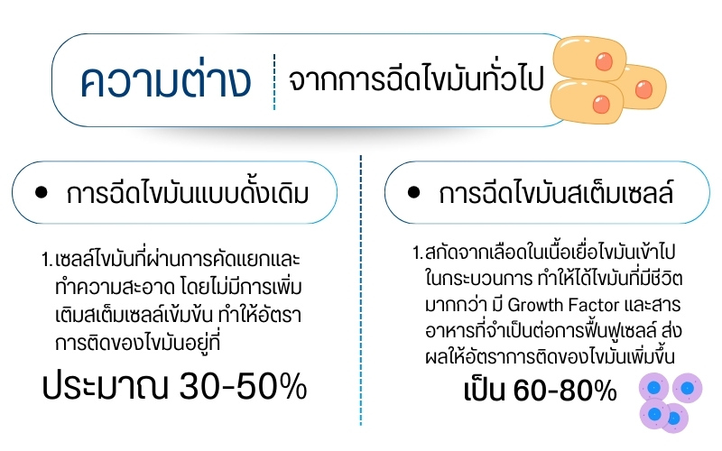 การฉีดไขมันสเต็มเซลล์คืออะไร