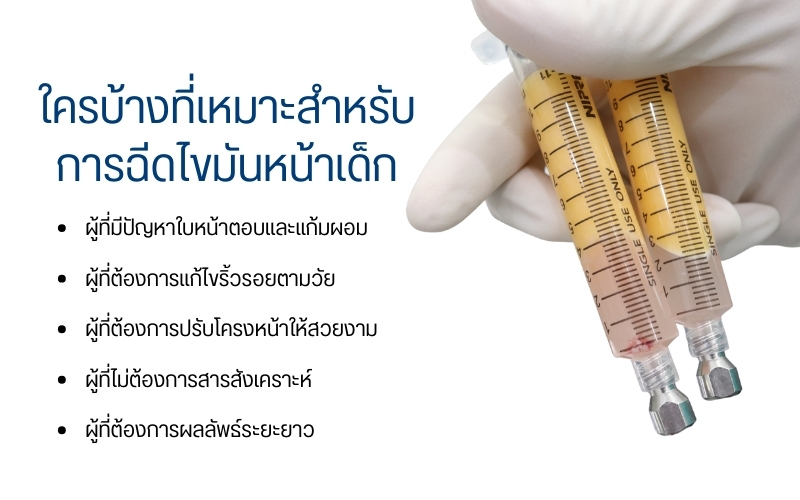 ใครบ้างที่เหมาะสำหรับการฉีดไขมันหน้าเด็ก