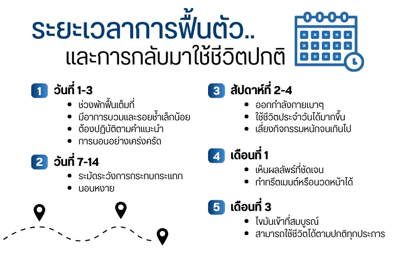 ระยะเวลาการฟื้นตัวและการกลับมาใช้ชีวิตปกติ