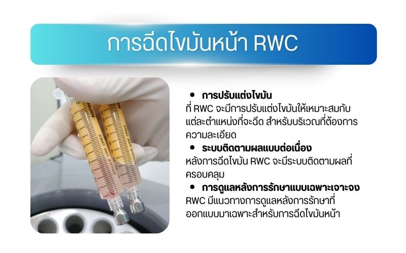 การฉีดไขมันหน้า RWC