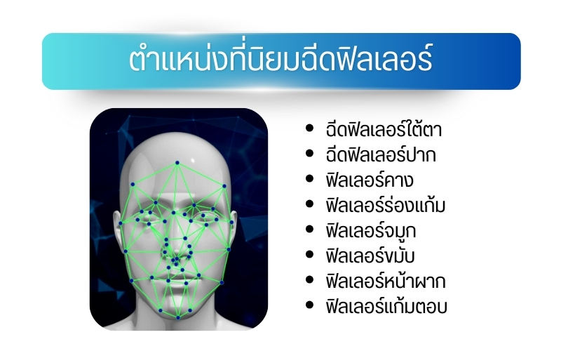 ตำแหน่งที่นิยมฉีดฟิลเลอร์