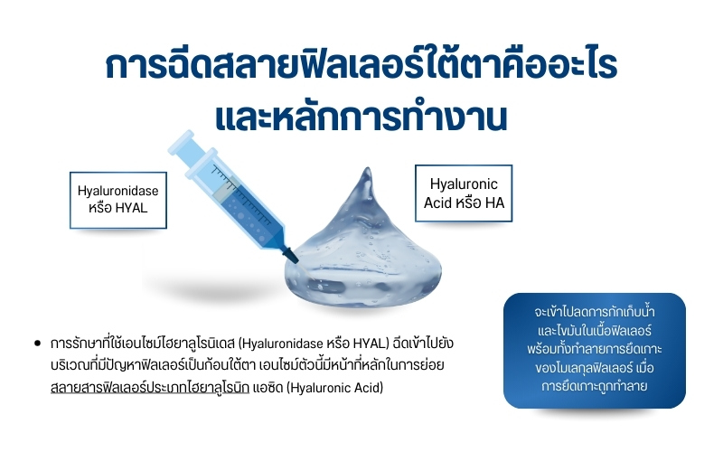 การฉีดสลายฟิลเลอร์ใต้ตา คืออะไร และหลักการทำงาน