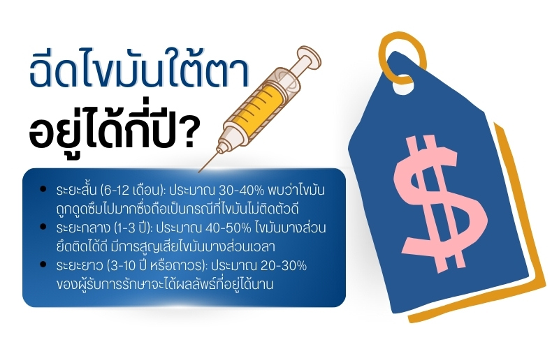ฉีดไขมันใต้ตาอยู่ได้กี่ปี