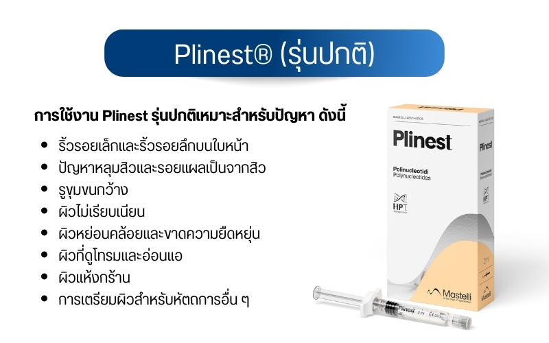 Plinest® (รุ่นปกติ)