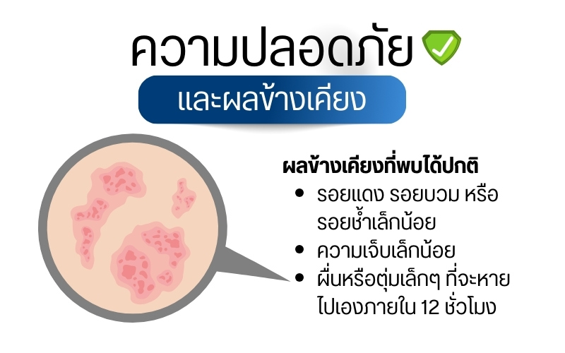 ความปลอดภัยและผลข้างเคียง