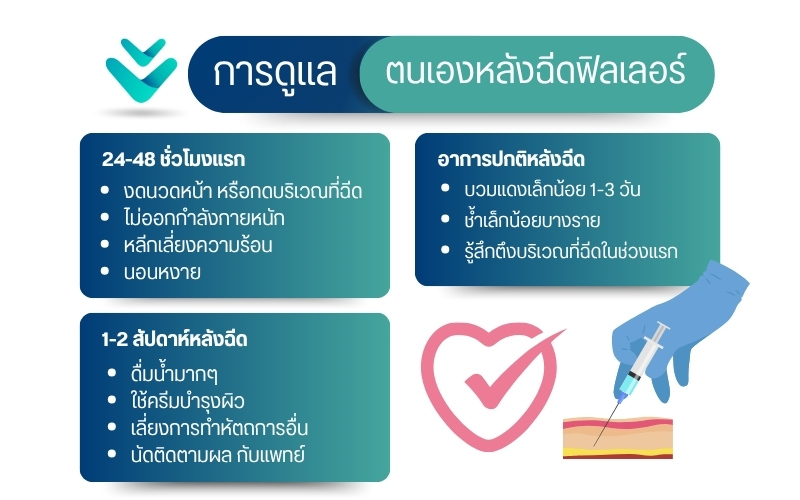 การดูแลหลังการฉีดฟิลเลอร์ Yvoire