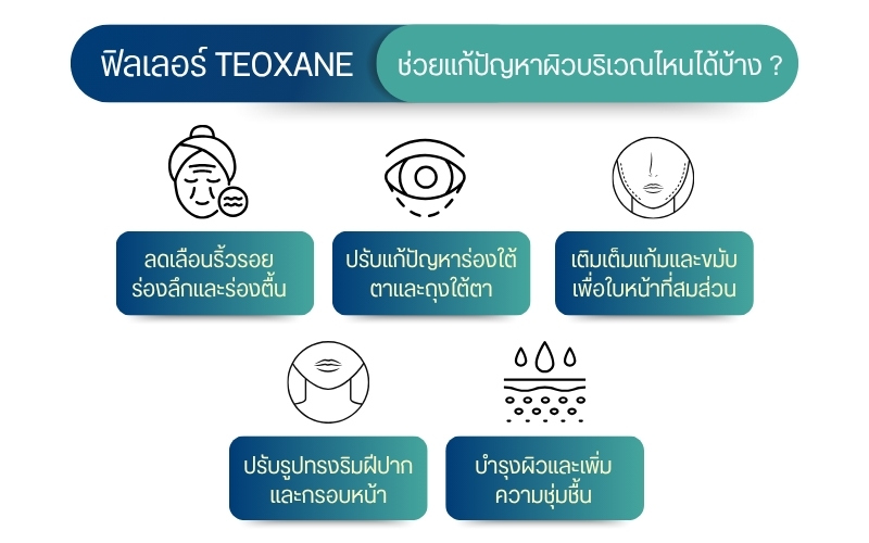 ฟิลเลอร์ Teoxane ช่วยแก้ปัญหาผิวบริเวณไหนได้บ้าง
