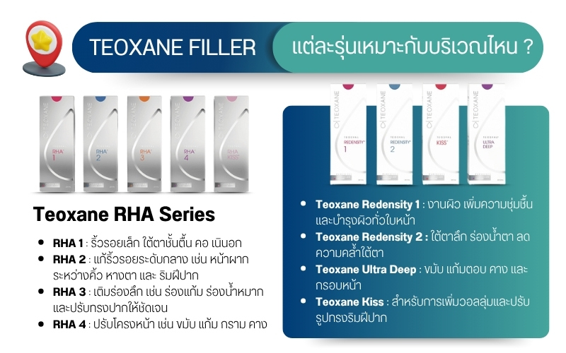 Teoxane Filler แต่ละรุ่นเหมาะกับบริเวณไหน