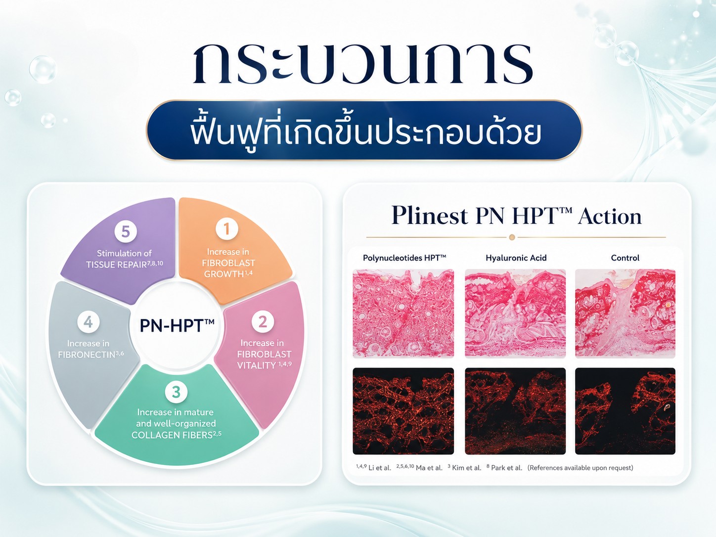 ส่วนประกอบของ Plinest