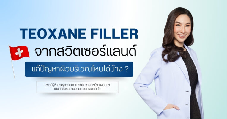 Teoxane Filler