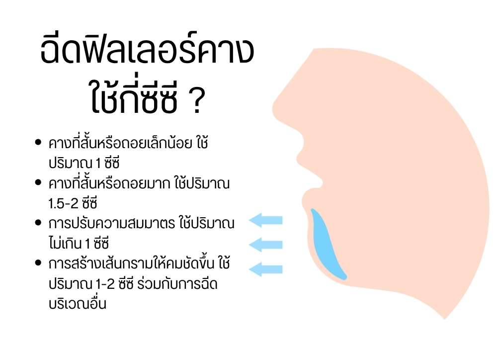 ฉีดฟิลเลอร์คางใช้กี่ซีซี ?