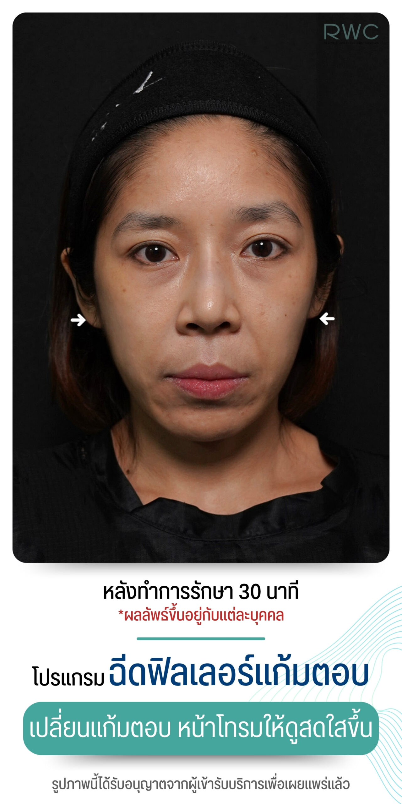 After image