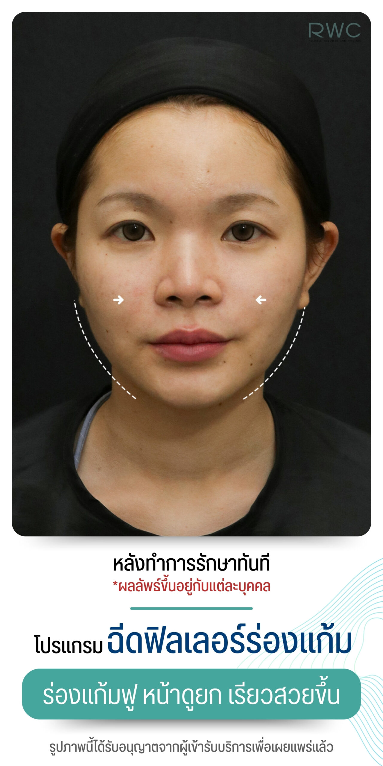 After image