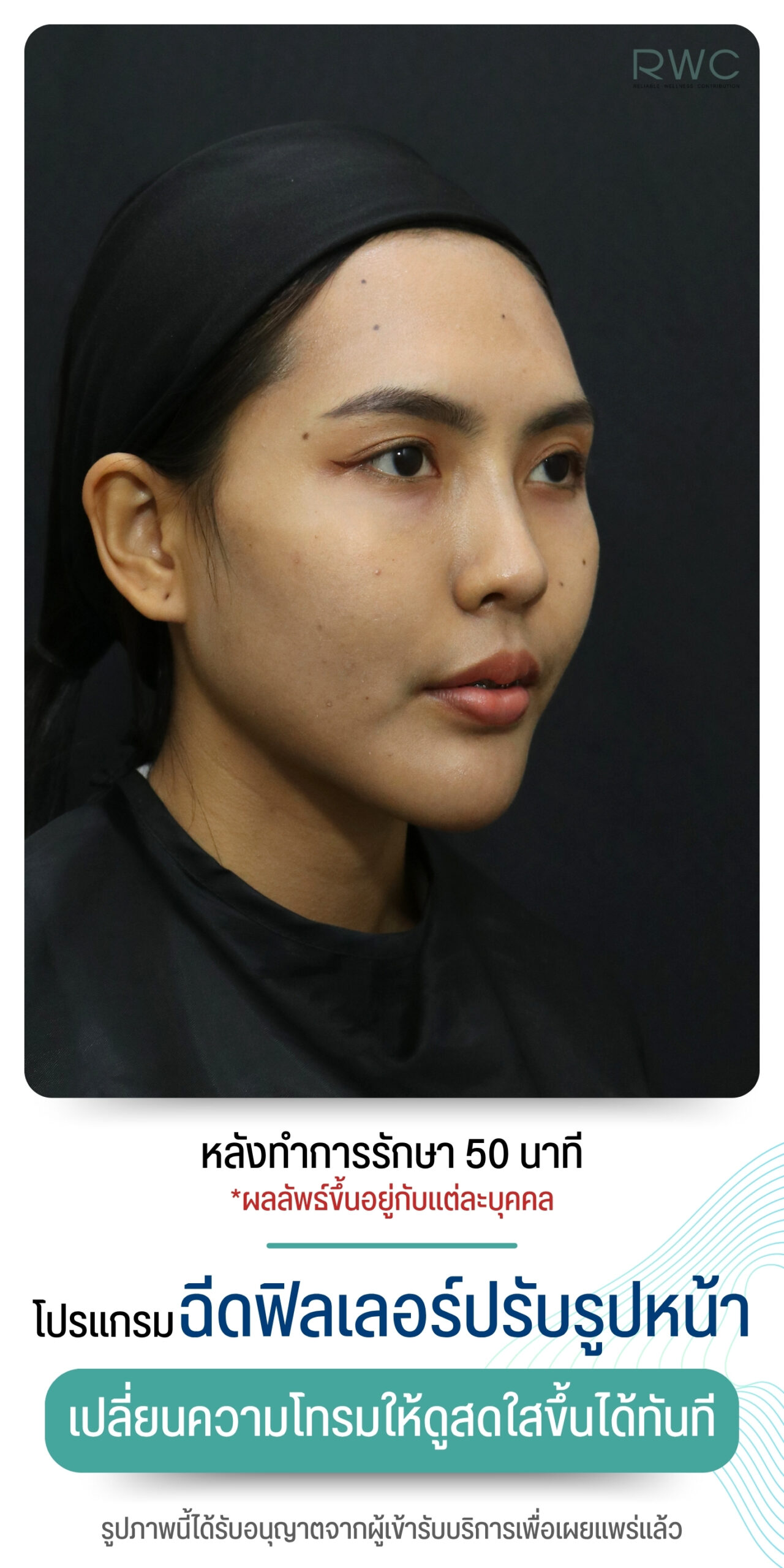 After image