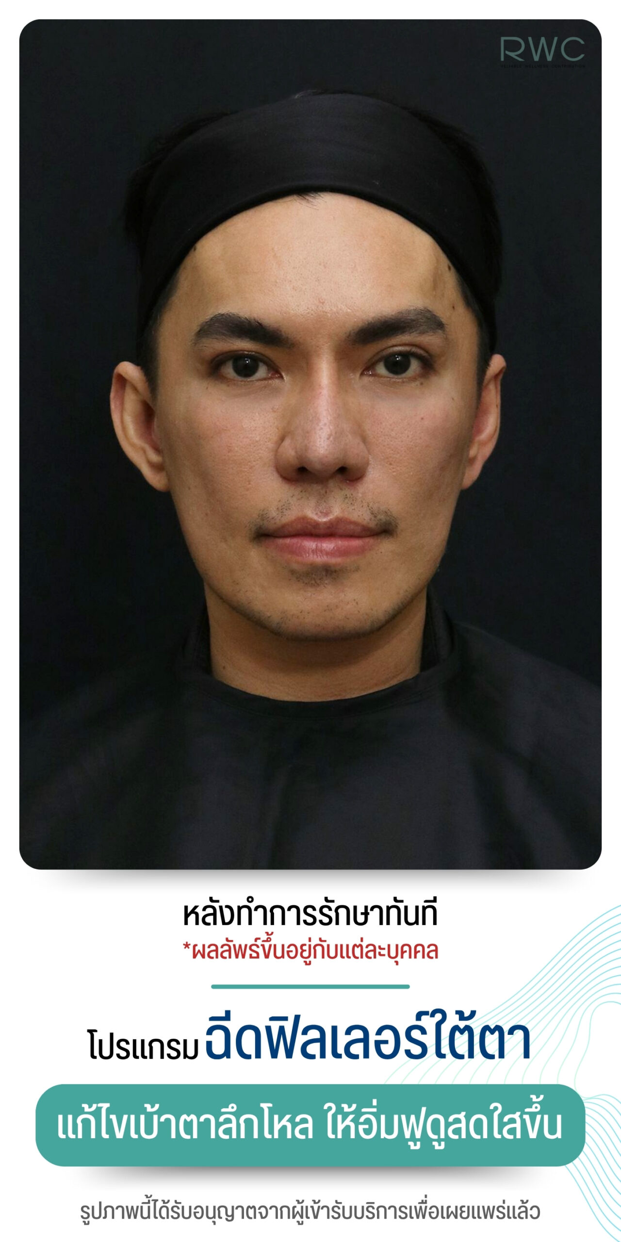 After image