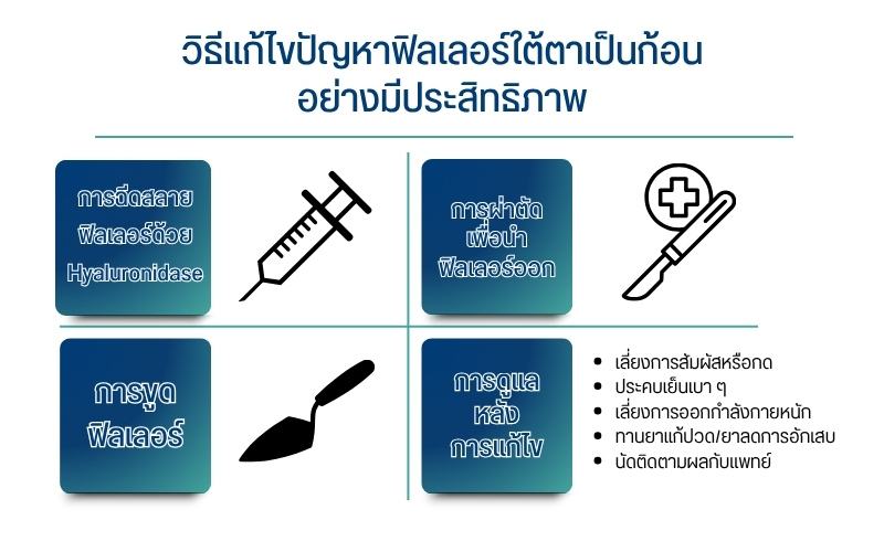 วิธีแก้ไขปัญหาฟิลเลอร์ใต้ตาเป็นก้อนอย่างมีประสิทธิภาพ