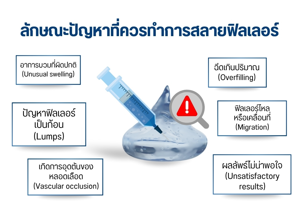 ลักษณะปัญหาที่ควรทำการสลายฟิลเลอร์