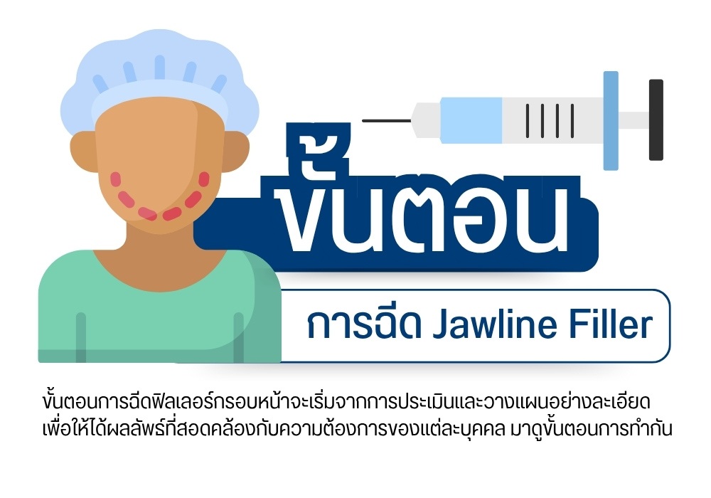 ขั้นตอนการฉีด Jawline Filler