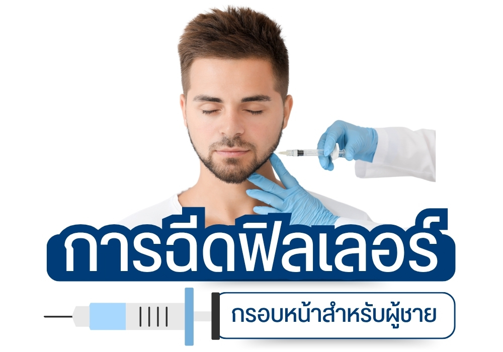 การฉีดฟิลเลอร์กรอบหน้าสำหรับผู้ชาย