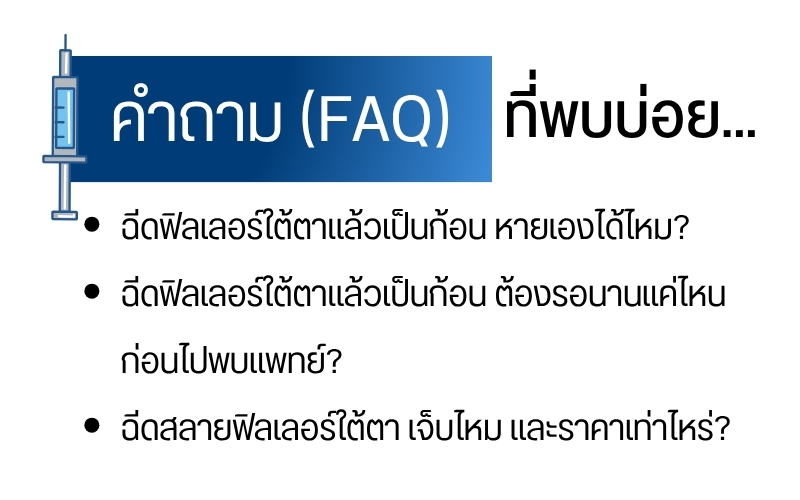 คำถามที่พบบ่อย