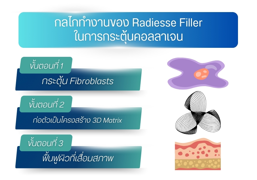 กลไกทำงานของ Radiesse Filler ในการกระตุ้นคอลลาเจน