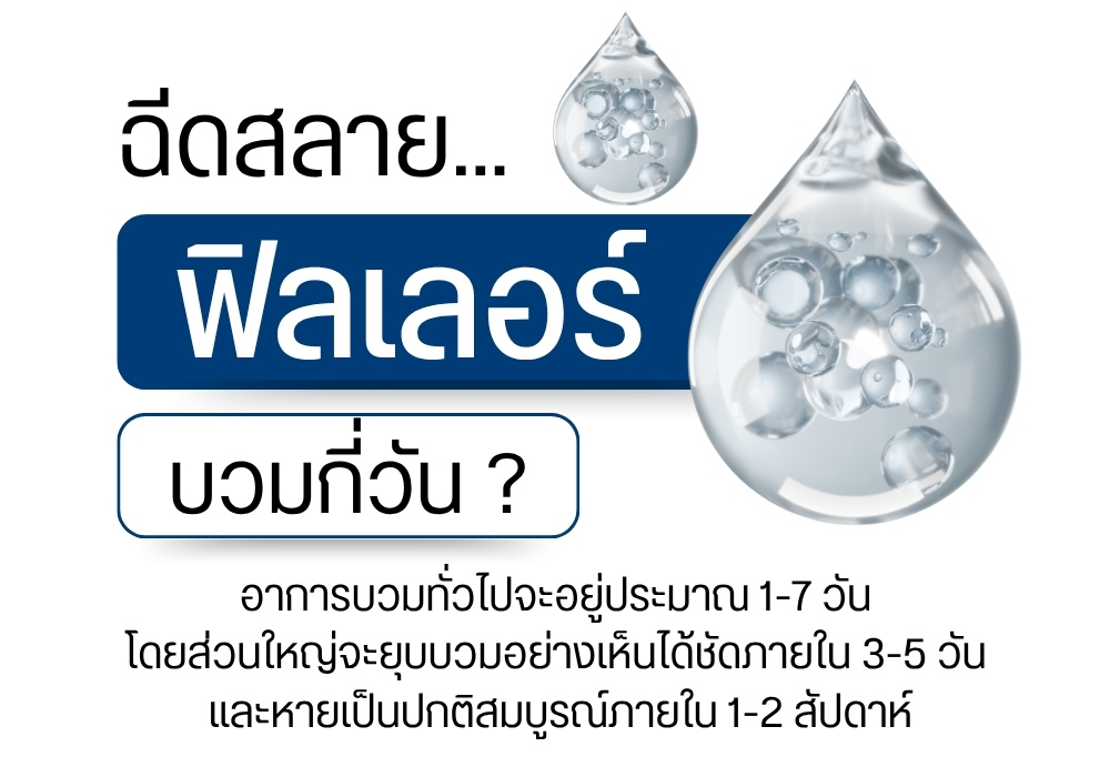 ฉีดสลายฟิลเลอร์บวมกี่วัน ?