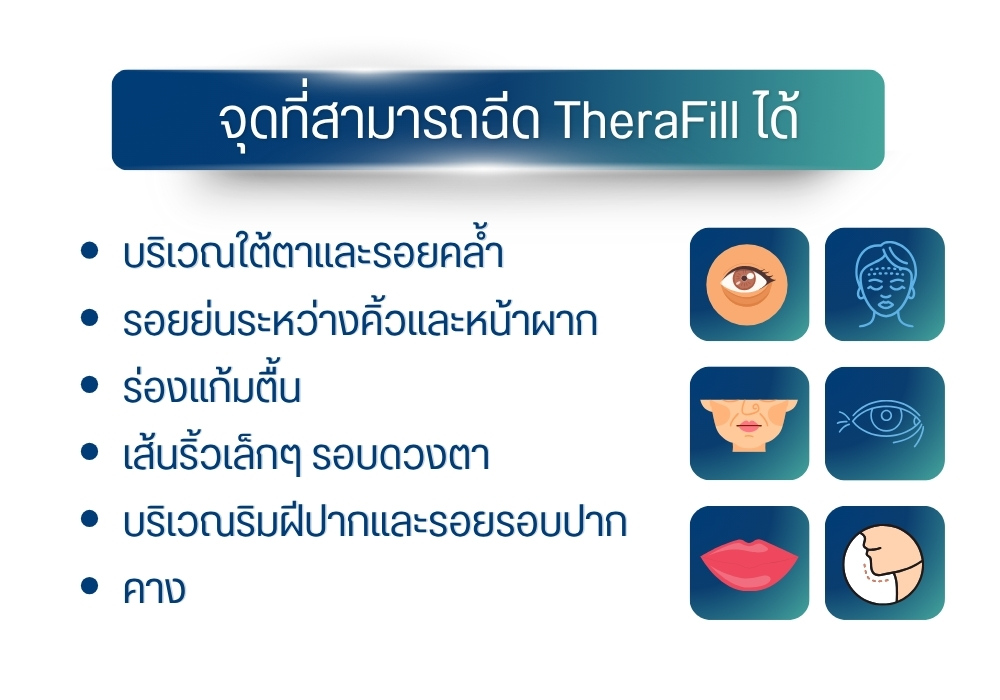 จุดที่สามารถฉีด TheraFill ได้