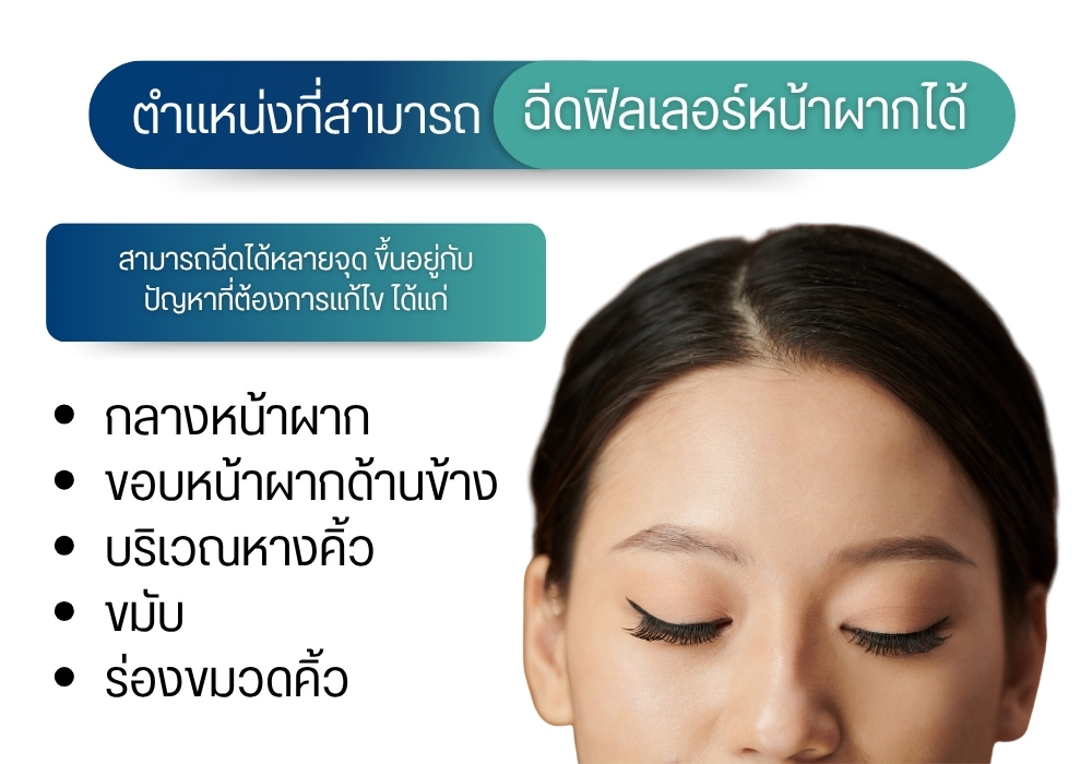 ฟิลเลอร์หน้าผาก คืออะไร ?