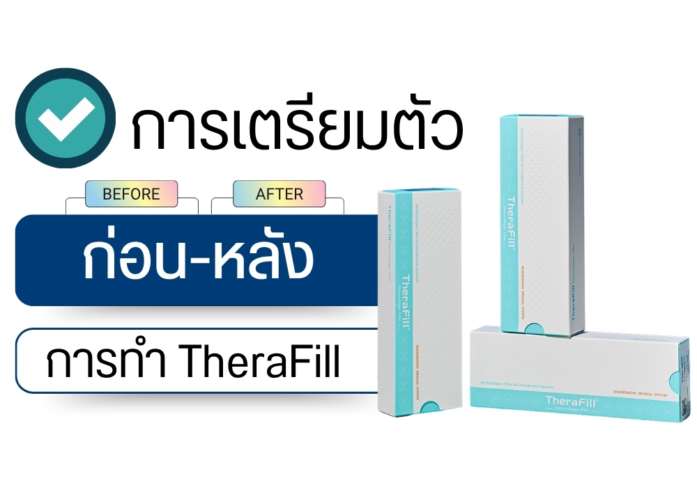 จุดที่สามารถฉีด TheraFill ได้
