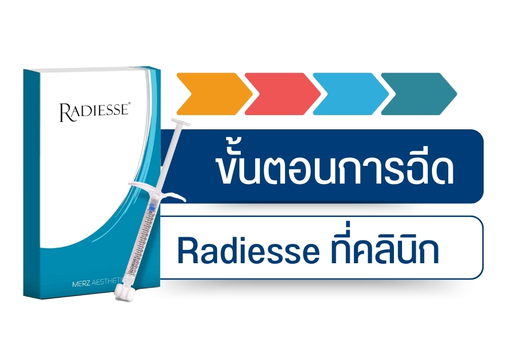 ขั้นตอนการฉีด Radiesse ที่คลินิก