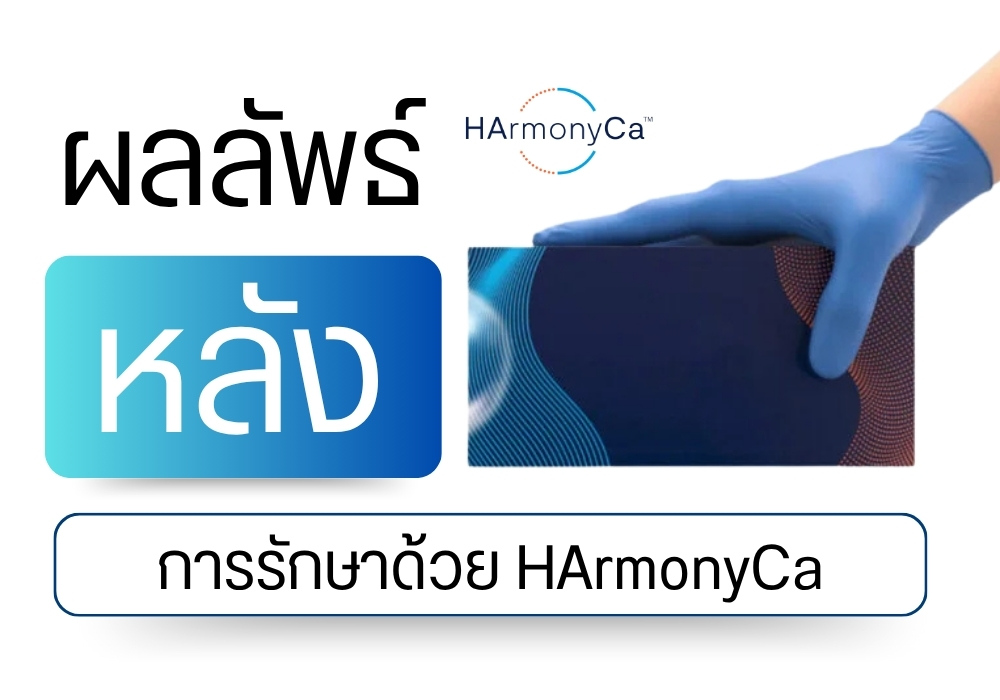 ผลลัพธ์หลังการรักษาด้วย HArmonyCa