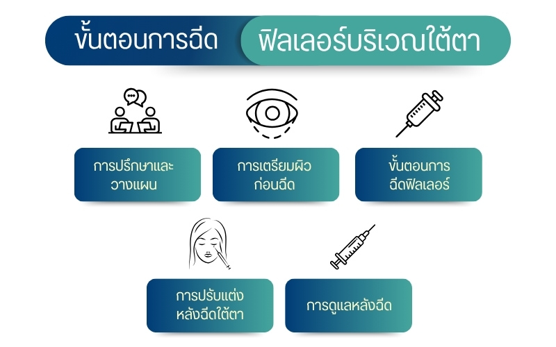 ขั้นตอนการฉีดฟิลเลอร์บริเวณใต้ตา