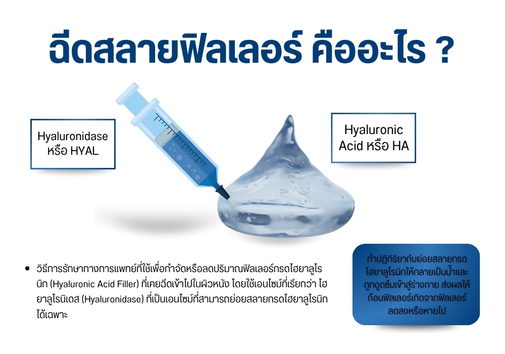 ฉีดสลายฟิลเลอร์ คืออะไร ?