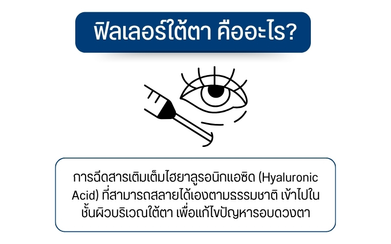 ฟิลเลอร์ใต้ตา คืออะไร