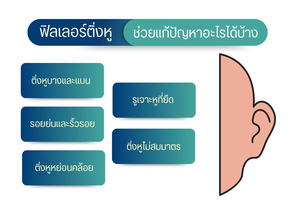 ฟิลเลอร์ติ่งหู ช่วยแก้ปัญหาอะไรได้บ้าง