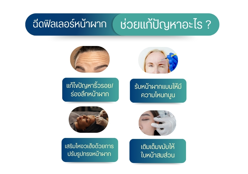 ฉีดฟิลเลอร์หน้าผาก ช่วยแก้ปัญหาอะไร