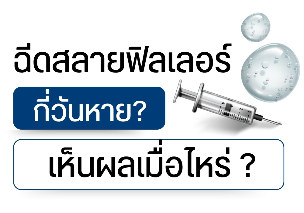 ฉีดสลายฟิลเลอร์กี่วันหาย เห็นผลเมื่อไหร่ ?