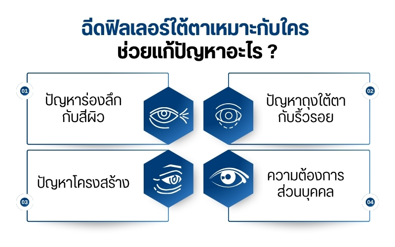 ฉีดฟิลเลอร์ใต้ตาเหมาะกับใคร ช่วยแก้ปัญหาอะไร ?