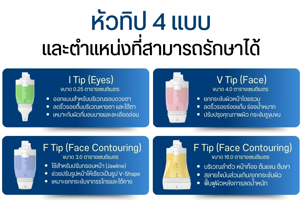 หัวทิป 4 แบบและตำแหน่งที่สามารถรักษาได้