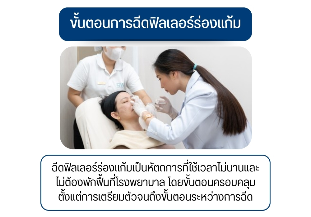 ขั้นตอนการฉีดฟิลเลอร์ร่องแก้ม