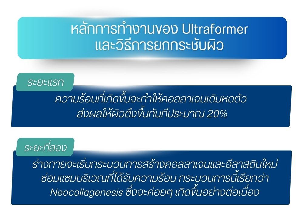 หลักการทำงานของ Ultraformer และวิธีการยกกระชับผิว
