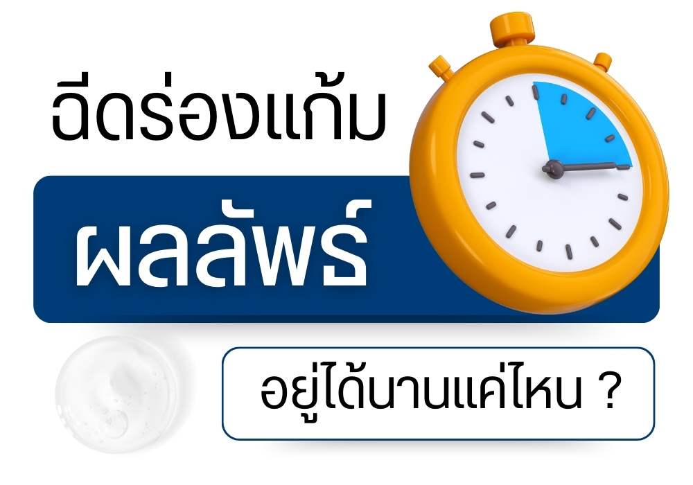 ฉีดฟิลเลอร์ร่องแก้ม ผลลัพธ์อยู่ได้นานแค่ไหน ?