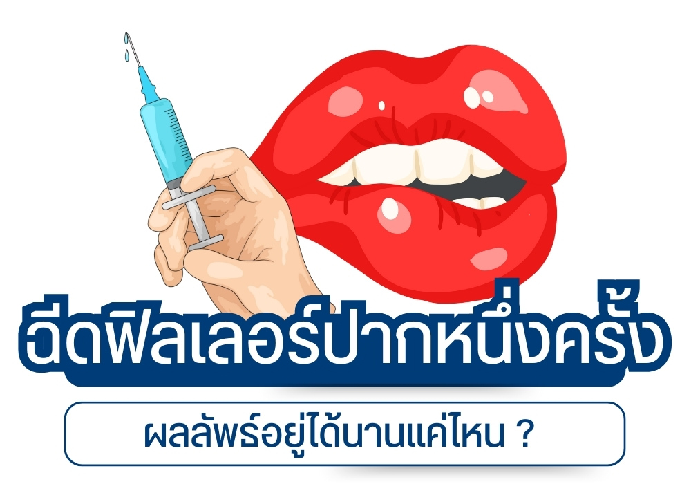 ฉีดฟิลเลอร์ปากหนึ่งครั้ง ผลลัพธ์อยู่ได้นานแค่ไหน ?