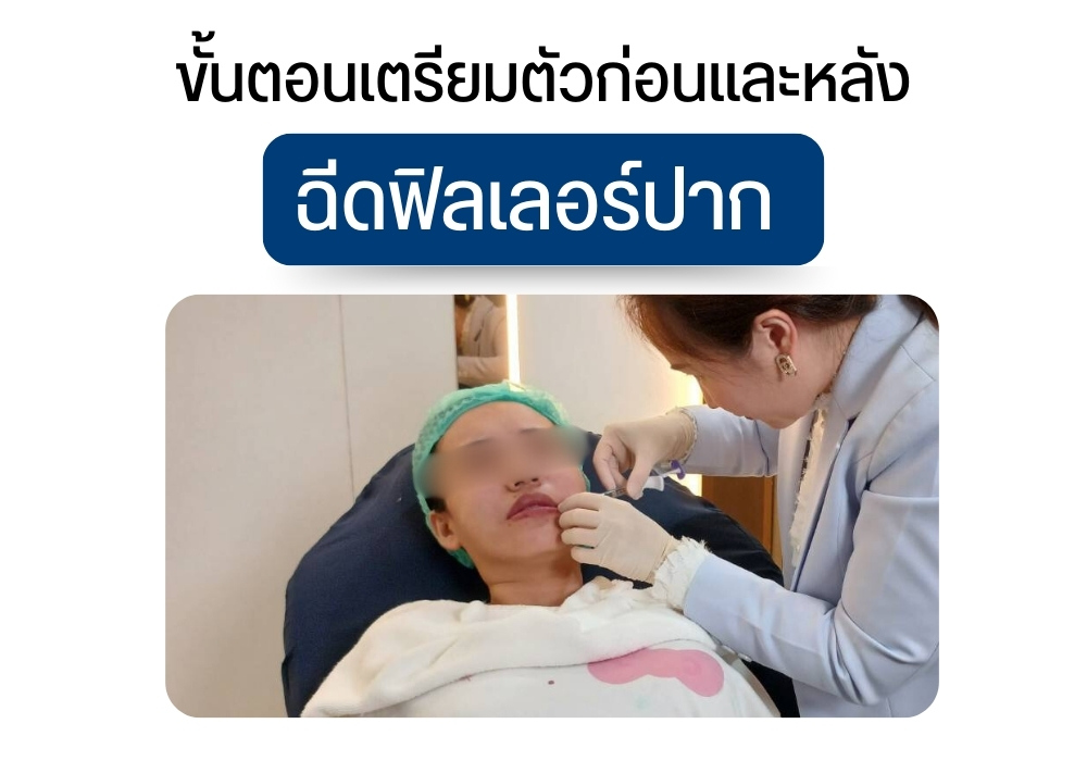 ขั้นตอนเตรียมตัวก่อนและหลังฉีดฟิลเลอร์ปาก